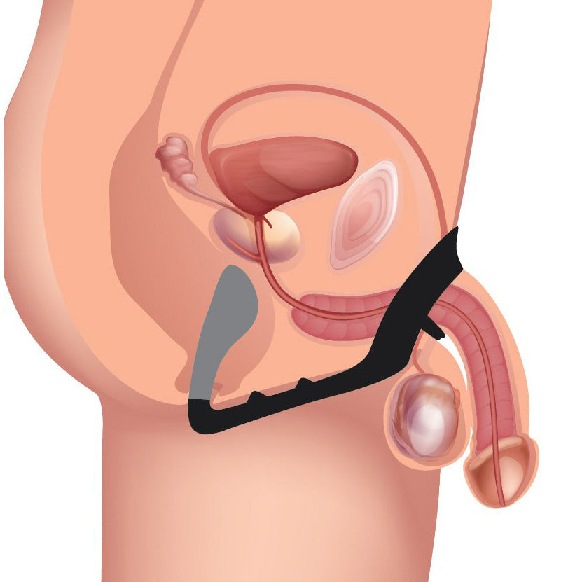 Excursion Silicone Triple Stim Anal Plug with Cock and Ball Ring